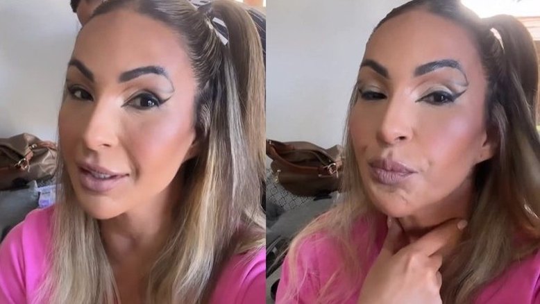 Valesca Popozuda passou por procedimento de harmonização facial