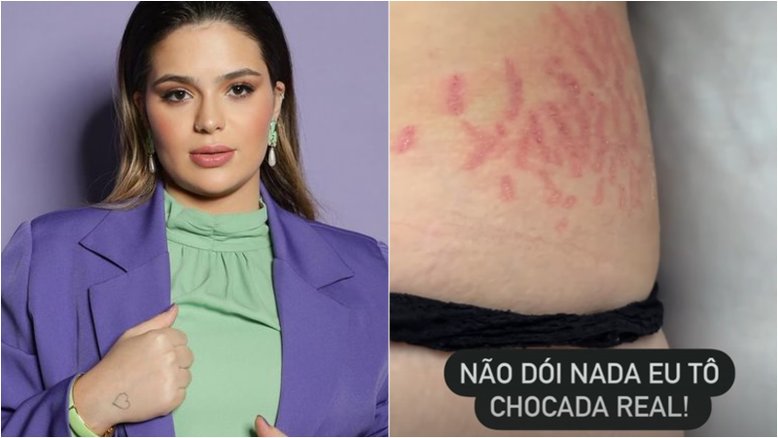 Viih Tube encara tratamento contra estrias após gravidez: ‘Voltando a me cuidar’