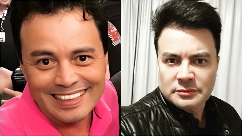 Sertanejo Renner apresenta resultado de nova harmonização facial e surpreende fãs