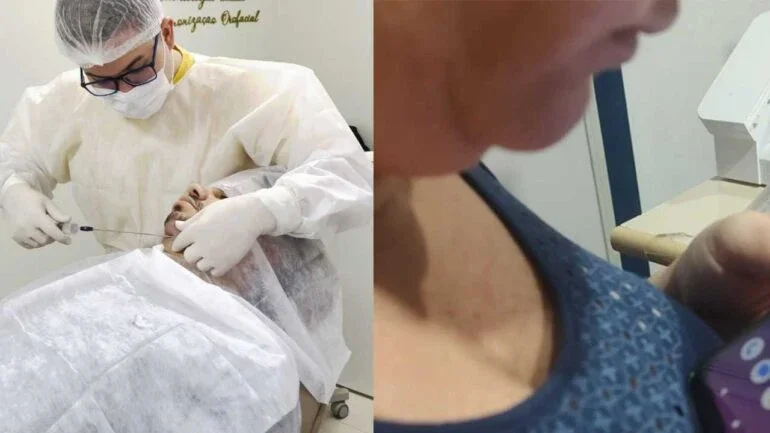 Tech Neck: O Uso Excessivo do Celular Contribui para a Papada e Rugas no Pescoço.