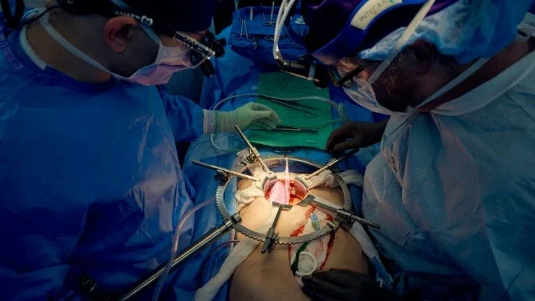 Coração de porco geneticamente modificado é transplantado para 2º paciente do mundo