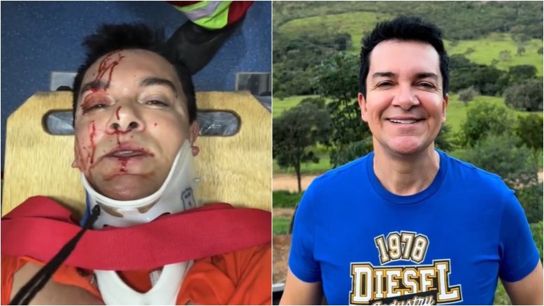 Cantor gospel Regis Danese sofre acidente em Goiás: ‘Orem por mim’