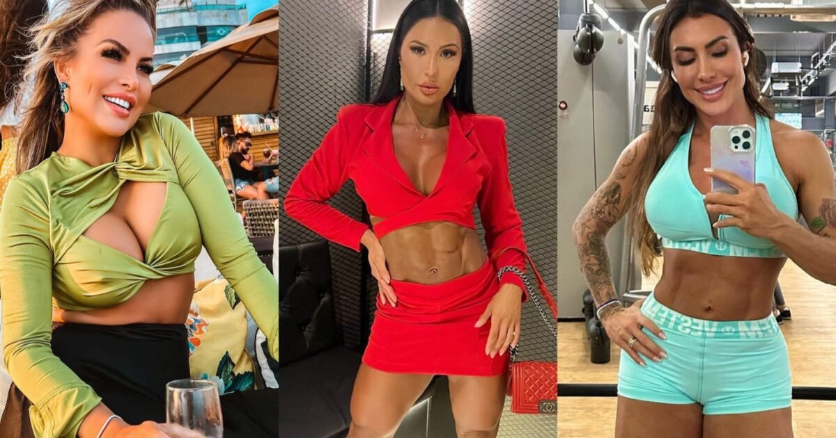 Celebridades se rendem a método não cirúrgico para eliminar celulites