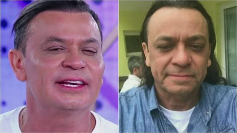 Frank Aguiar se compara com Brad Pitt depois de harmonização facial