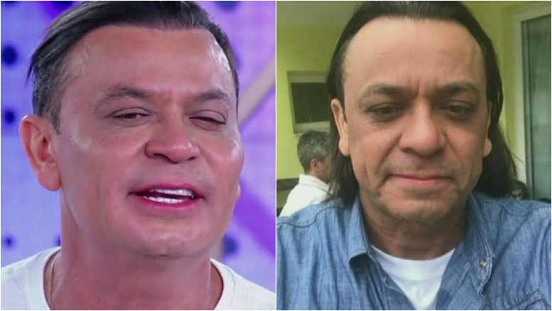Frank Aguiar se compara com Brad Pitt depois de harmonização facial