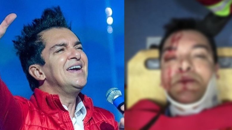 Estado grave, perfuração no intestino e boletim médico: o que se sabe sobre o acidente de Regis Danese