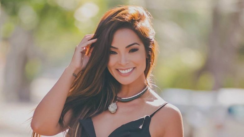 Após Carol Nakamura realizar nova troca de lentes dentárias, especialista alerta sobre necessidade do procedimento