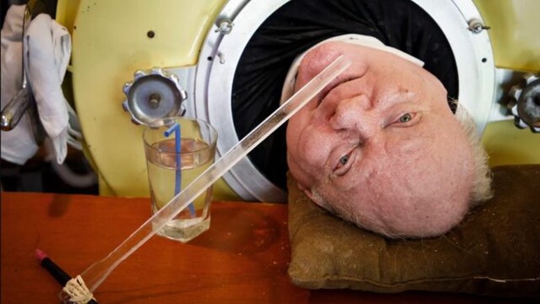 Como 'Polio Paul' sobreviveu vivendo dentro de um pulmão de ferro por 70 anos