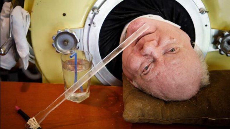 Como 'Polio Paul' sobreviveu vivendo dentro de um pulmão de ferro por 70 anos