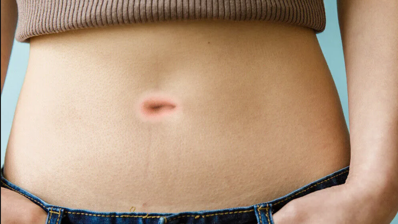 Mulheres usam umbigos falsos para que as pernas pareçam mais longas