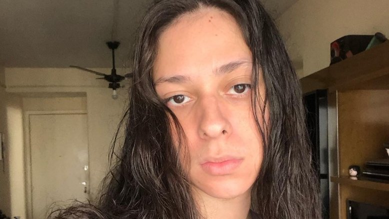 Ator Victor Meyniel é agredido no Rio e defesa alega homofobia
