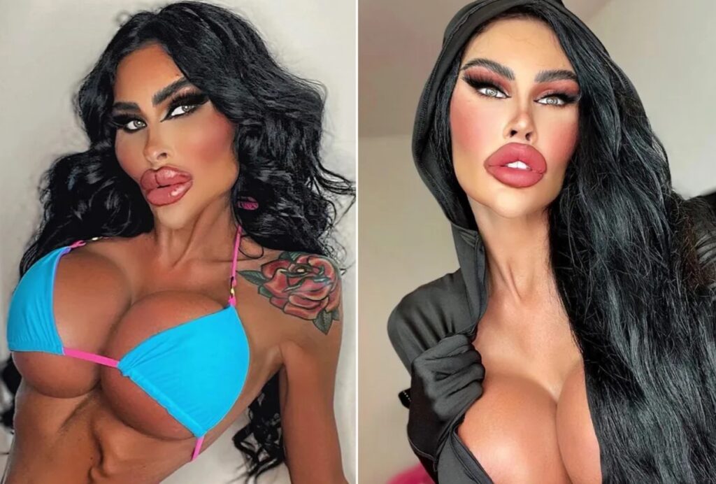 Antes e depois de Tara Jayne, conhecida como 'Barbie Humana'