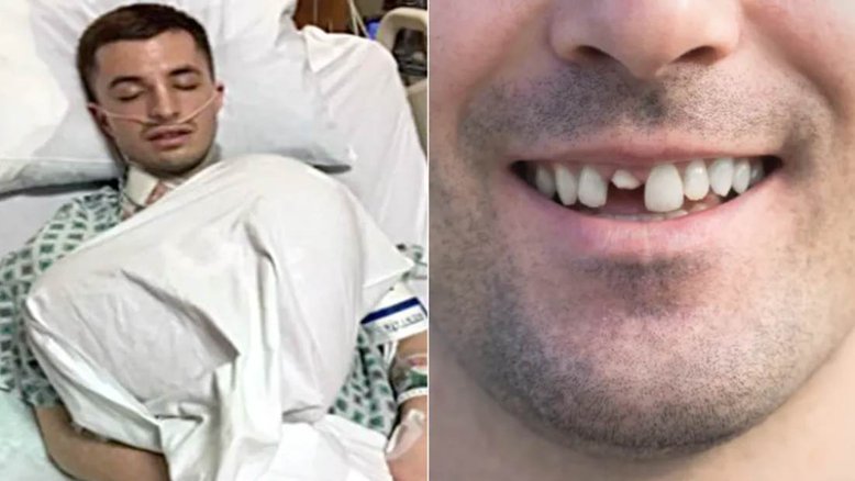 Homem vai parar na UTI após quebrar dente e contrair infecção nos EUA
