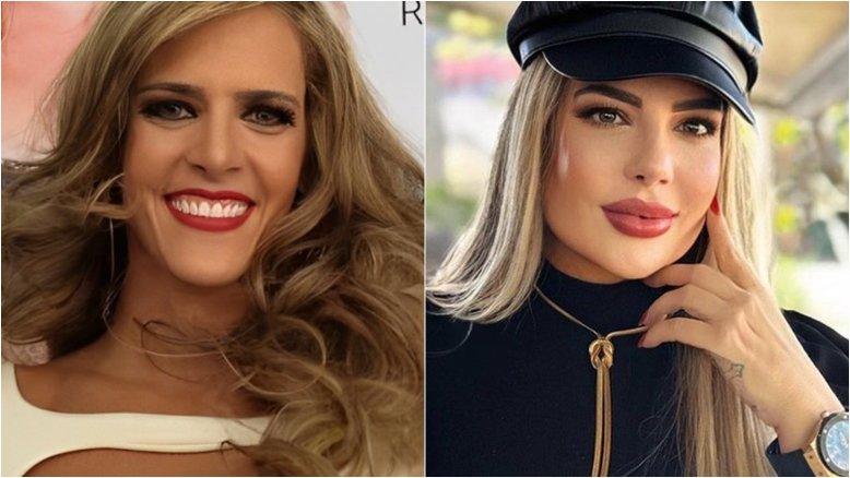Denise Rocha surpreende ao mostrar nova harmonização facial; saiba quanto modelo já investiu em procedimentos