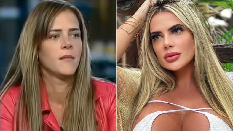 Denise Rocha impressiona com novos procedimentos estéticos: ‘Outra pessoa pela segunda vez’