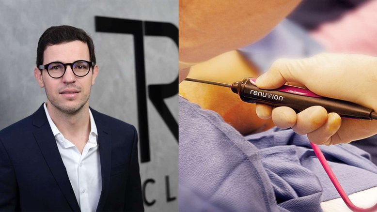 O médico Thiago Paoliello, especialista em Renuvion
