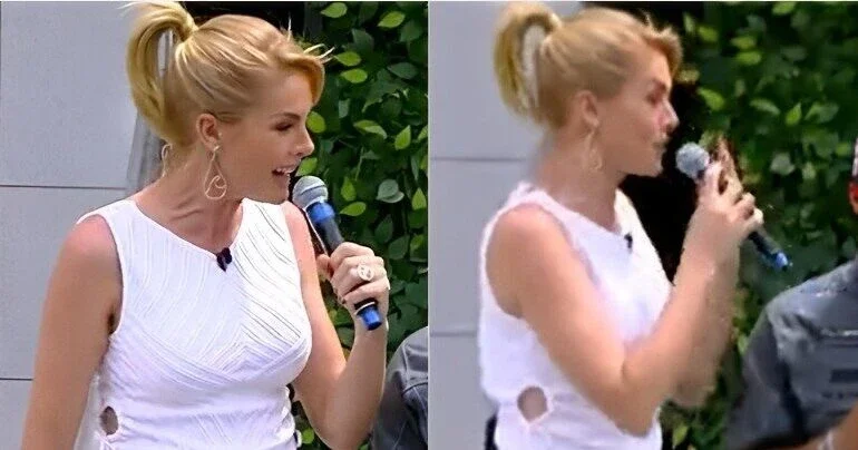 Ana Hickmann deixa escapar hematoma no braço após caso de agressão; vídeo