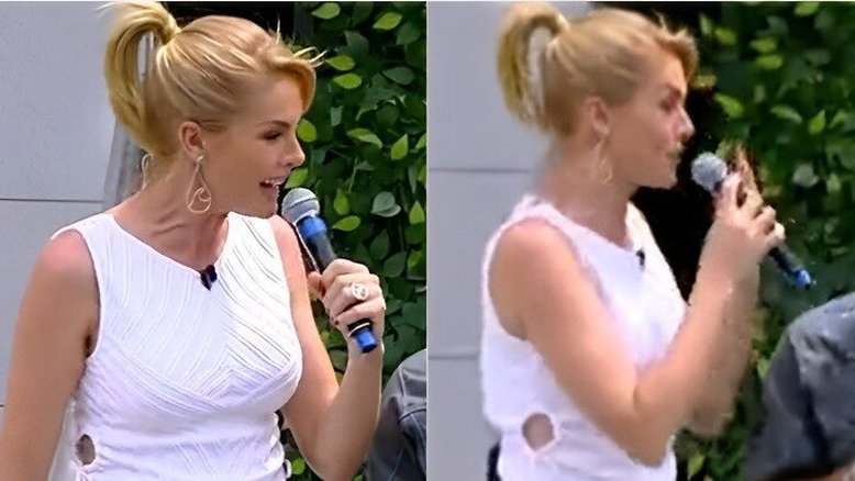 Ana Hickmann deixa escapar hematoma no braço após caso de agressão; vídeo