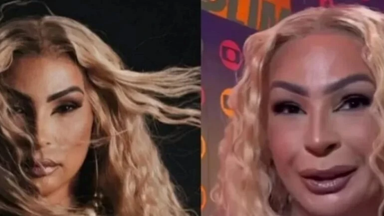 Após aparição no Prêmio Multishow, Valesca Popozuda diz se fez plásticas no rosto