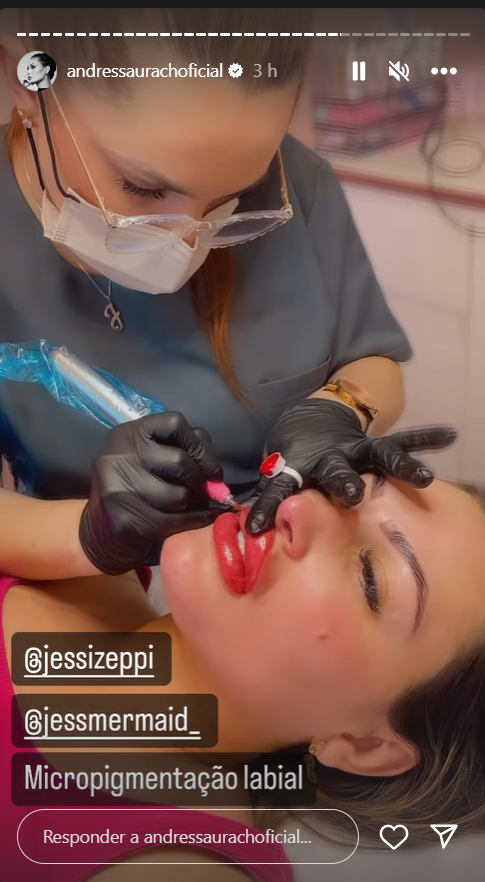 Andressa Urach apresenta resultado de procedimento estético na boca: ‘Efeito batom’ 4 Andressa Urach apresenta resultado de procedimento estético na boca: ‘Efeito batom’