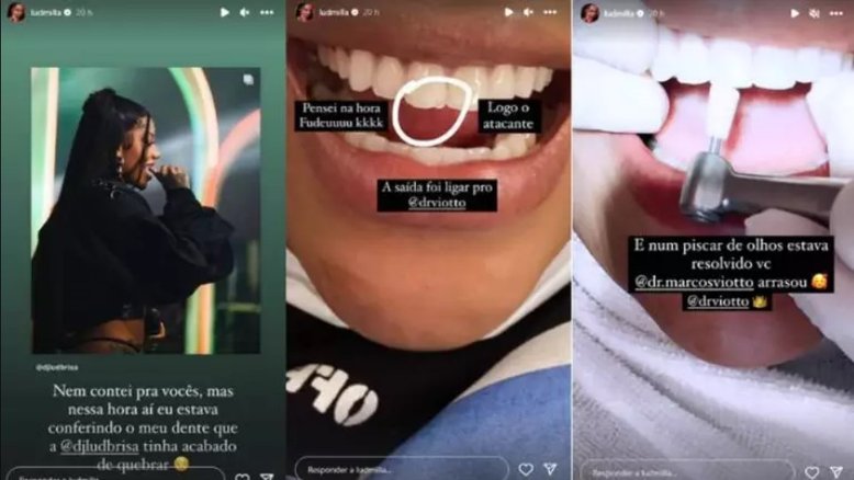 Ludmilla mostra ter quebrado dente durante show do 'Numanice' em Curitiba