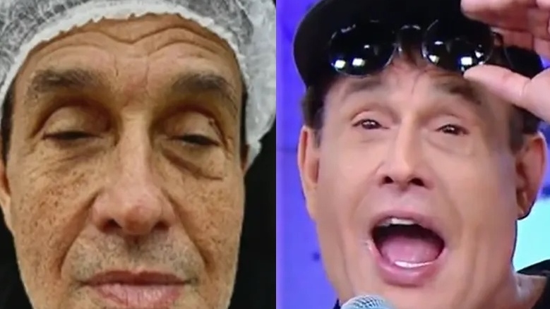 Sérgio Mallandro faz sua terceira harmonização facial: 'Eu queria parecer com o Tom Cruise'