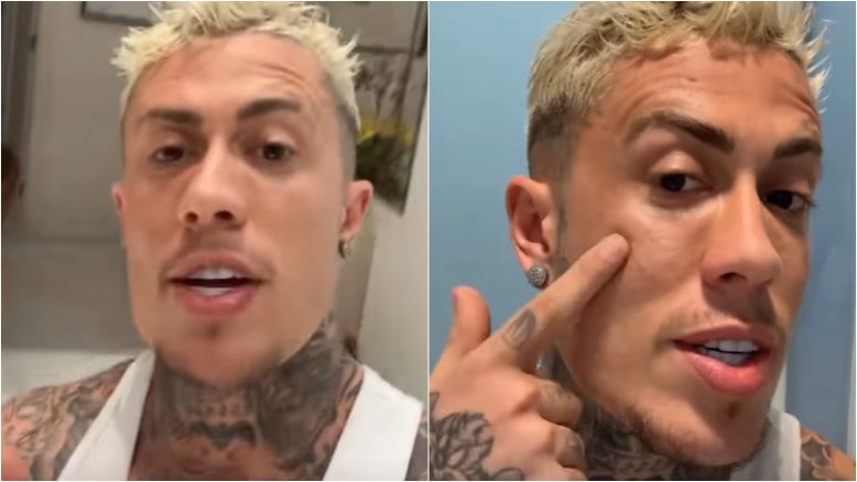MC Daniel sai na briga com namorado de fã e exibe o machucado: ‘Cabeçada’