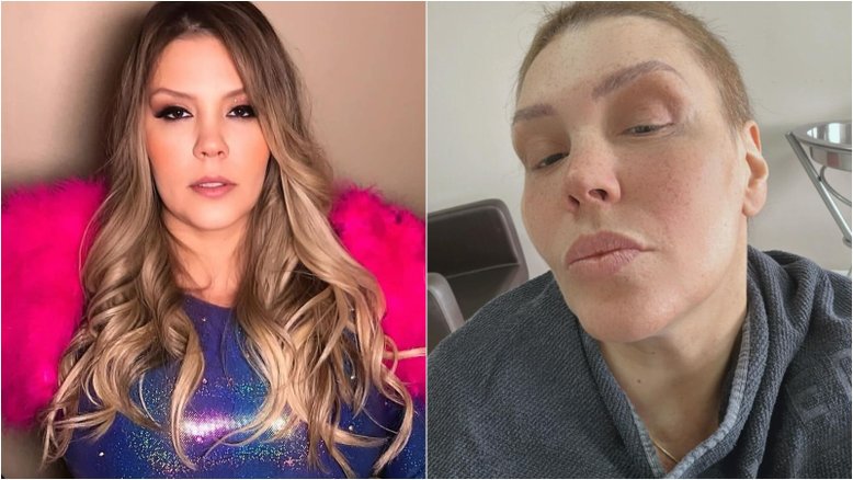 Simony exibe o cabelo após fim da quimio e comemora: 'Já cresceu!'