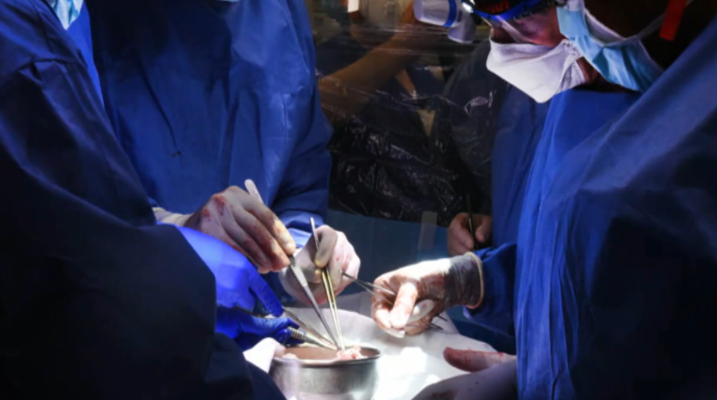 Segunda pessoa a receber transplante de coração de porco morre quase dois meses após cirurgia