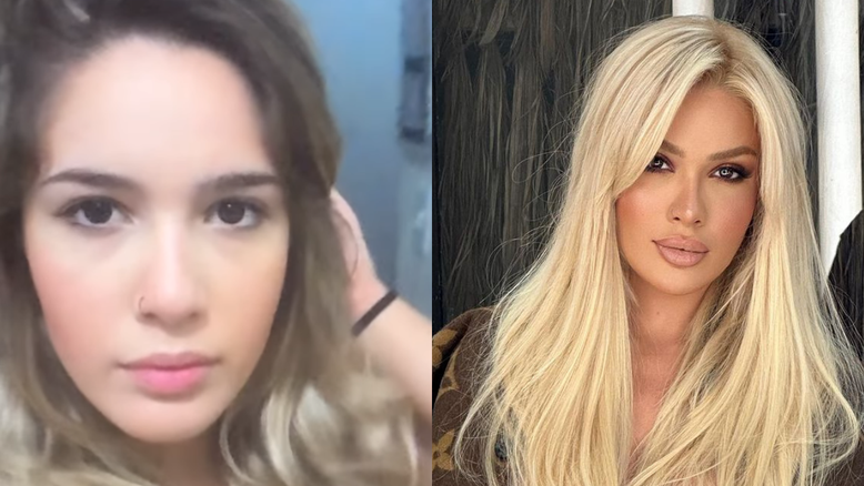 Karoline Lima surpreende fãs ao compartilhar fotos antigas sem preenchimento labial