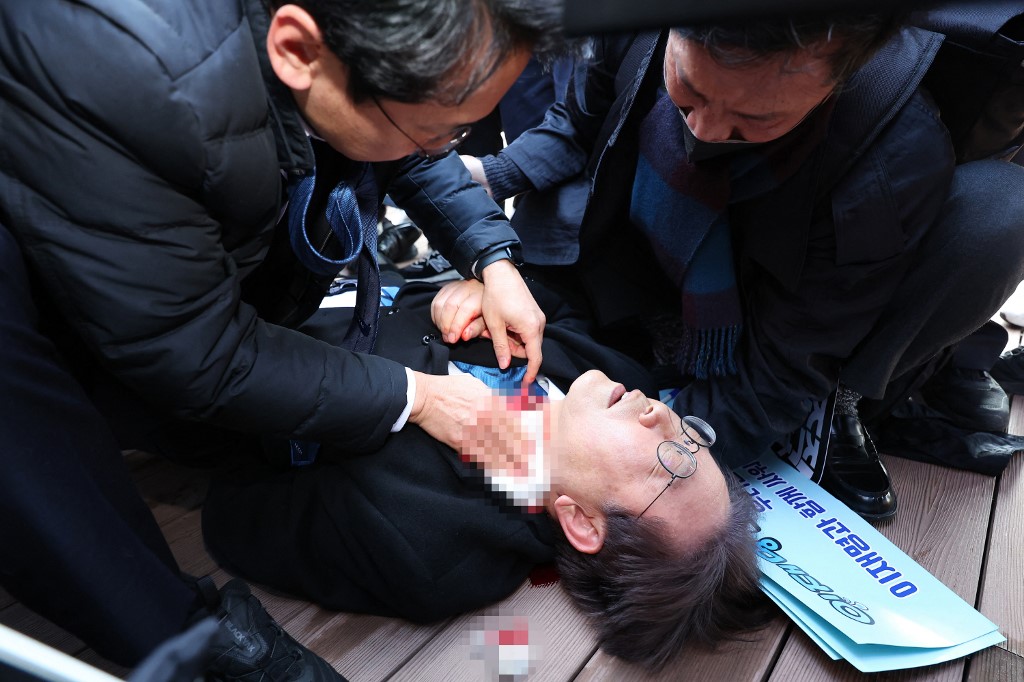 O líder do partido de oposição sul-coreano, Lee Jae-myung, é atendido após ser atacado em Busan em 2 de janeiro de 2024
