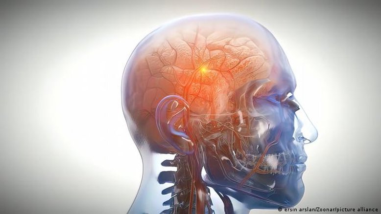 Variante genética pode reduzir risco de Parkinson em 50%