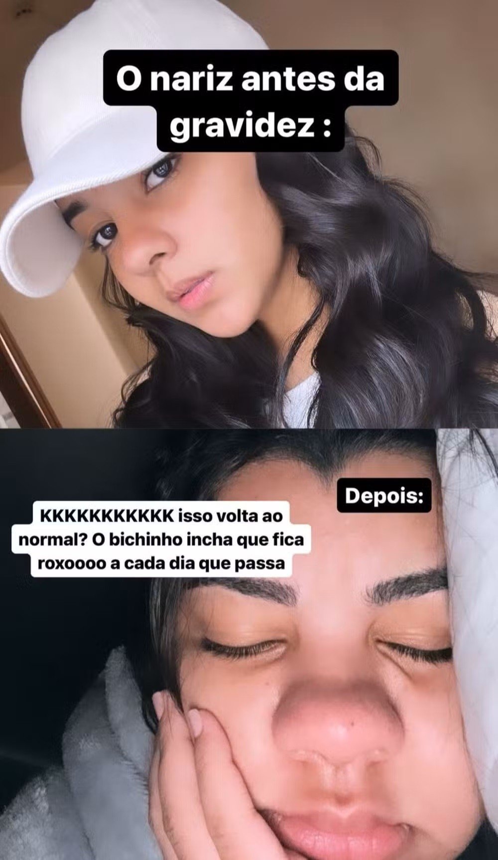 Grávida de João Gomes, Ary Mirelle mostra mudanças no rosto: 'Fica roxo' 2 Grávida de João Gomes, Ary Mirelle mostra mudanças no rosto: 'Fica roxo'