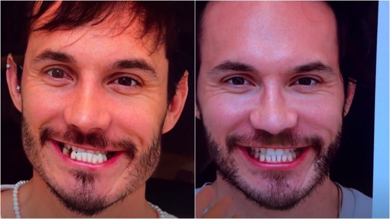 Eliezer impressiona ao mostrar antes e depois de tratamento odontológico: ‘Irreconhecível’