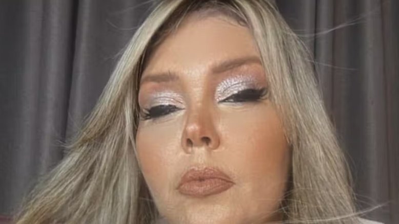 Simony surge com rosto inchado e é criticada na web