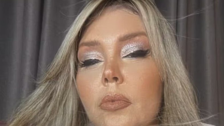 Simony surge com rosto inchado e é criticada na web