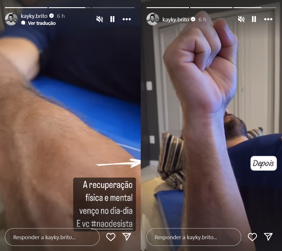 Kayky Brito comemora evolução na fisioterapia cinco meses após acidente: ‘Não desista’