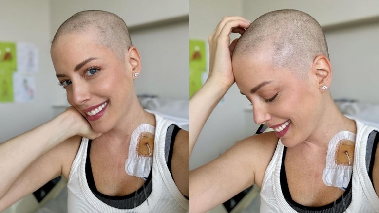 Assim como Fabiana Justus: veja famosos que já foram diagnosticados com leucemia