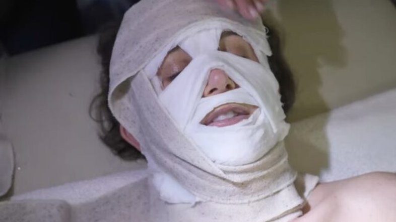 Ioga facial e choque elétrico: especialistas avaliam exercícios para obter queixo esculpido