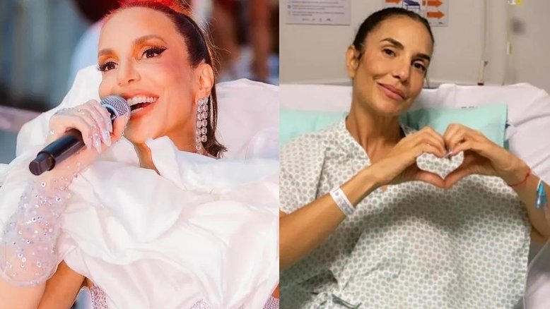 Médico explica o que é pneumonia bacteriana: doença que fez Ivete Sangalo ser internada