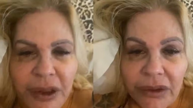 'Não consigo comer', desabafa Monique Evans após ser diagnosticada com dengue