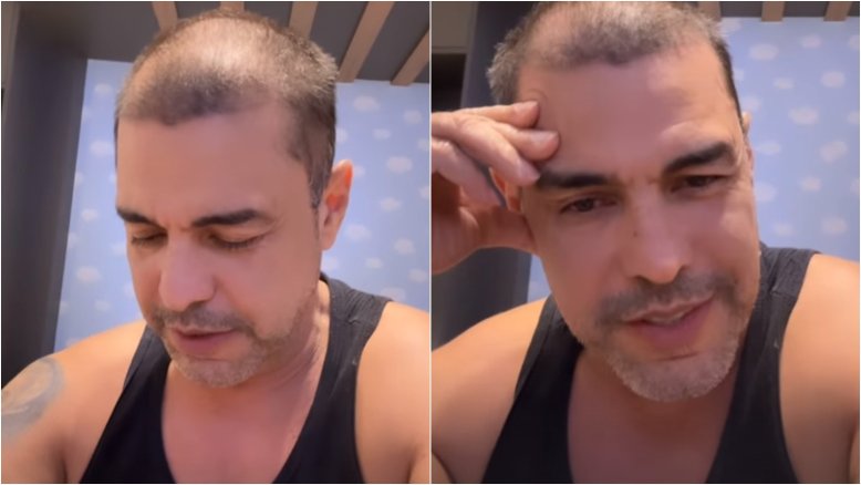 Zezé Di Camargo surpreende ao surgir careca