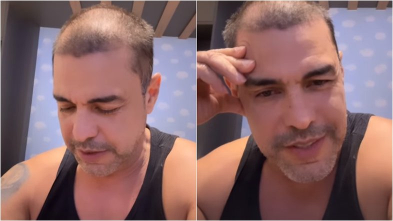 Zezé Di Camargo surpreende ao surgir careca