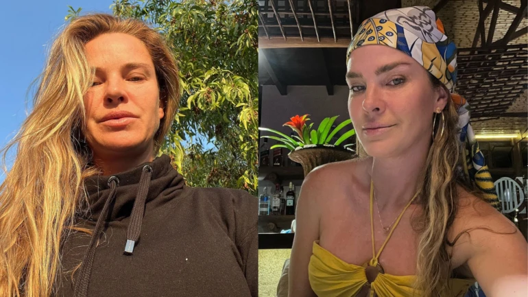 Leticia Birkheuer denuncia agressão em restaurante pelo ex-marido: 