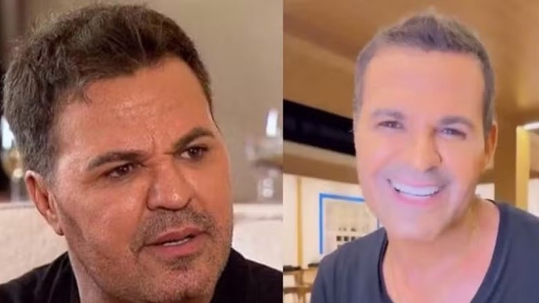 Eduardo Costa abre o jogo e fala sobre magreza excessiva: 'Perdi 20kg com ajuda de um profissional'