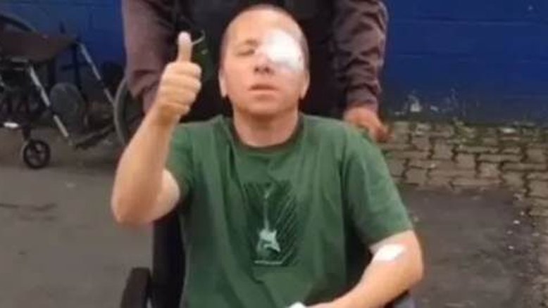 PM é baleado no olho, mata suspeito e dirige até o hospital