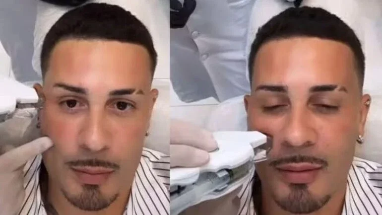 De sêmen a picadas de abelha: os peculiares tratamentos de beleza dos famosos