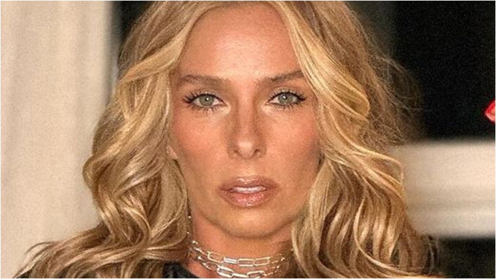 Adriane Galisteu fala sobre doença autoimune: ‘Devo ter perdido uns 60%