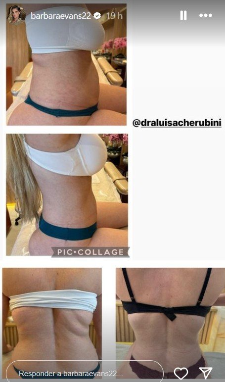 Conheça a estratégia que Bárbara Evans adotou para eliminar 17 kg após parto 2 Story de Bárbara Evans