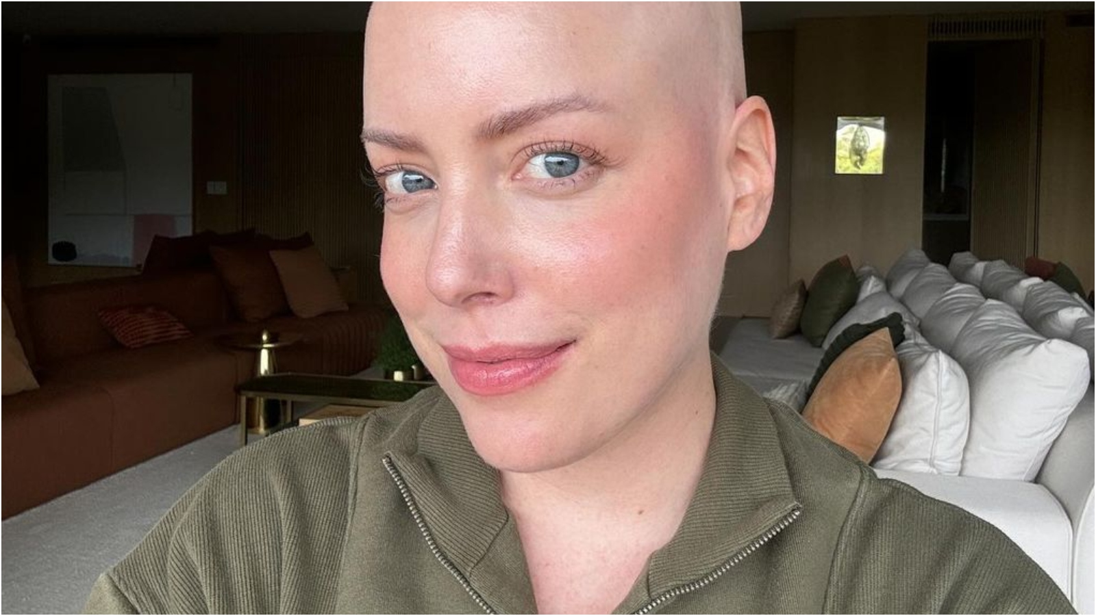Fabiana Justus conta por que não usou touca de resfriamento para evitar queda de cabelo na quimioterapia
